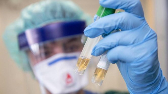 Єврокомісія виділила 100 мільйонів євро для купівлі експрес-тестів на антигени