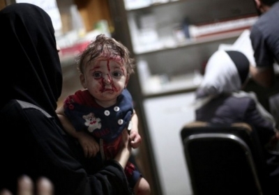 Сирія, Дума, 3 серпня 2014 року. Поранена дитина чекає у госпіталі міста Дума поблизу Дамаску. Щонайменше 32 людини загинули під час бомбардування міст, які контролюють повстанці поблизу столиці. Фото: АFР