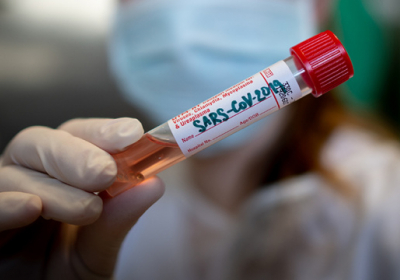 Рада підтримала обов’язкове масове тестування на коронавірус