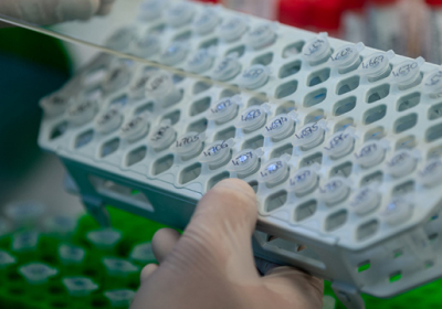 Институт молекулярной биологии НАН может производить до 50 000 тестов в неделю, но нет денег