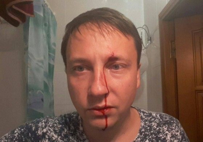 На Одещині побили депутата міськради

