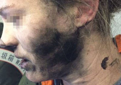 У жінки під час польоту в літаку вибухнули навушники, - ФОТО
