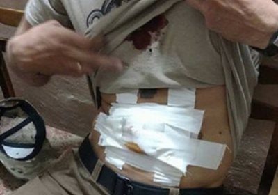 Стрілянина в Одесі: поранено лідера міської організації ВГО 