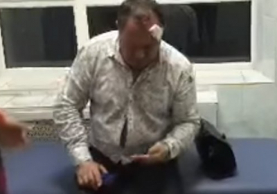 В Харькове пьяный полицейский протаранил столб на служебном авто - ВИДЕО