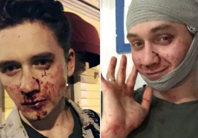 В Киеве неизвестные избили двух парней, якобы, из-за 
