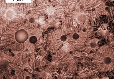 Електронна мікрофотографія q-скельця. Фото: Bendersky / NIST