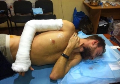 Активіст Євромайдану з поламаною рукою та розривом легені вирвався з рук 