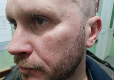 В Одессе напали на журналиста 
