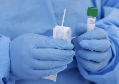 МОЗ радить робити тест на коронавірус за будь-яких ознак застуди