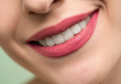 Секреты обворожительной улыбки: всё об отбеливании зубов
