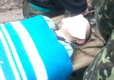 Военные медики ВСУ лечат раненых пленных сепаратистов, - фото